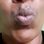 Bekilove Menge